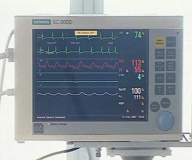Умеренность в желаниях - здоровое сердце