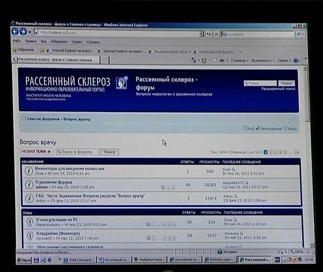 Рассеянный склероз