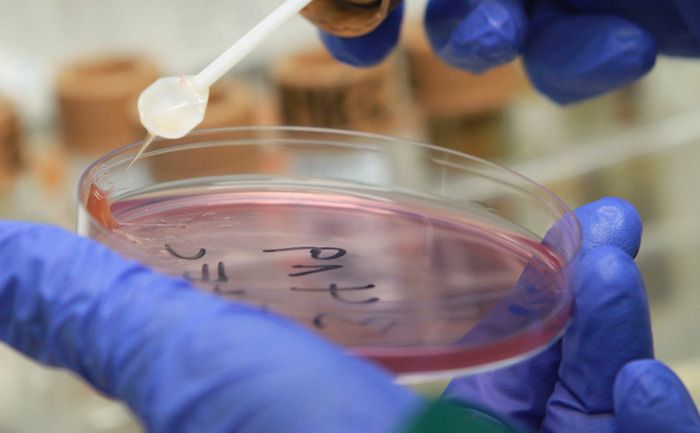 В Кировской области зафиксирован рост заболеваний кишечными инфекциями.