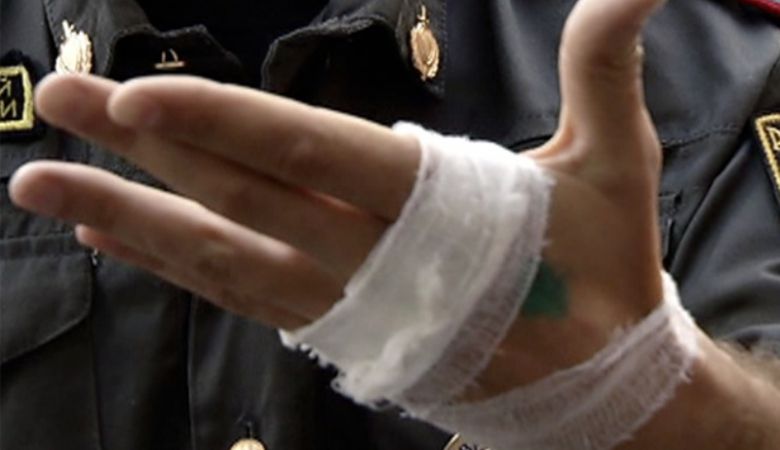 Жителя Нововятска, покусавшего полицейского, приговорили к условному сроку.