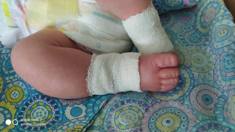 Следователи проверят, как в кировской больнице новорожденному травмировали ногу