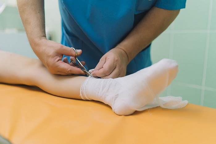 В Кирове врачи спасли девочку с ожогами 41% тела