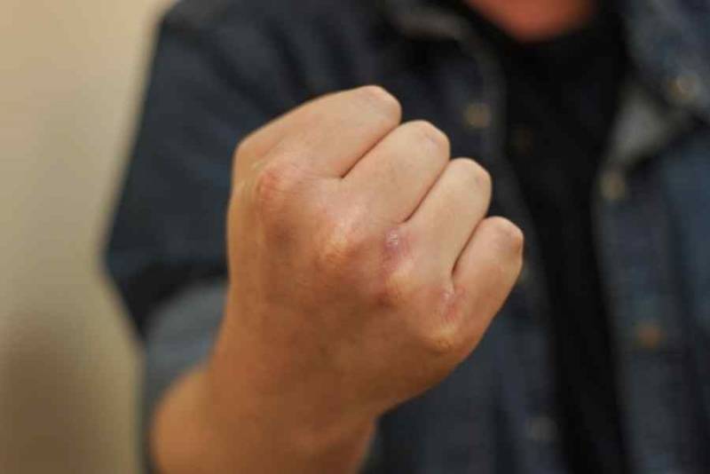 В Нолинске 16-летний подросток предстанет перед судом за истязание своей матери и кражу ее денег