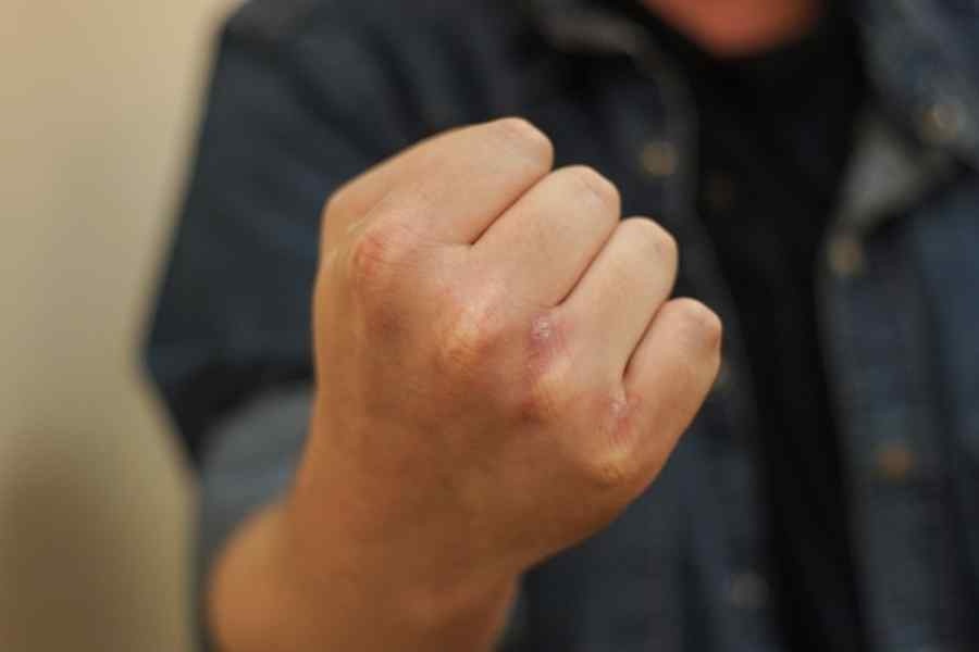 Кировчанина обвиняют в нанесении смертельных побоев своему брату