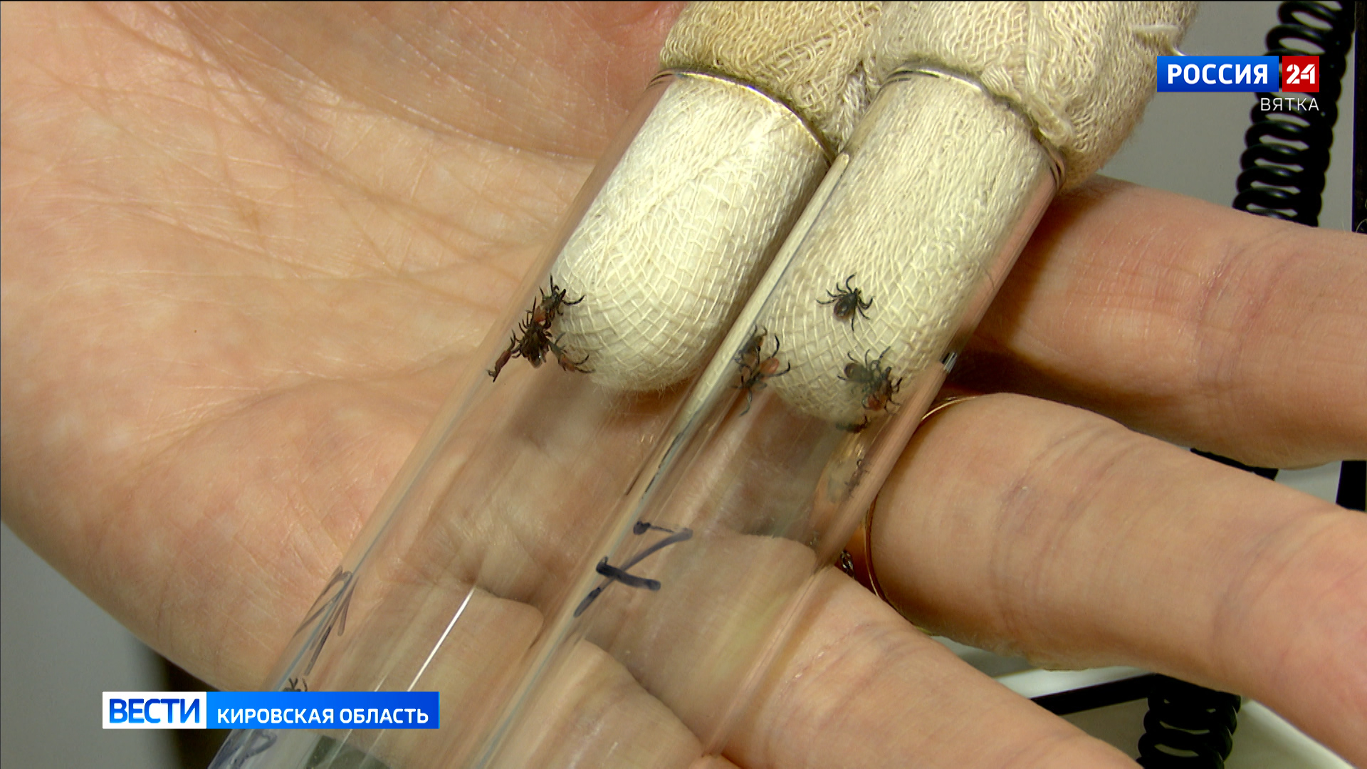 От укусов клещей пострадали 249 жителей Кировской области