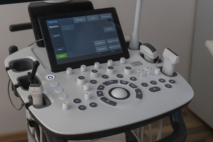 Для пациентов Кировской области установили аппарат УЗИ экспертного класса