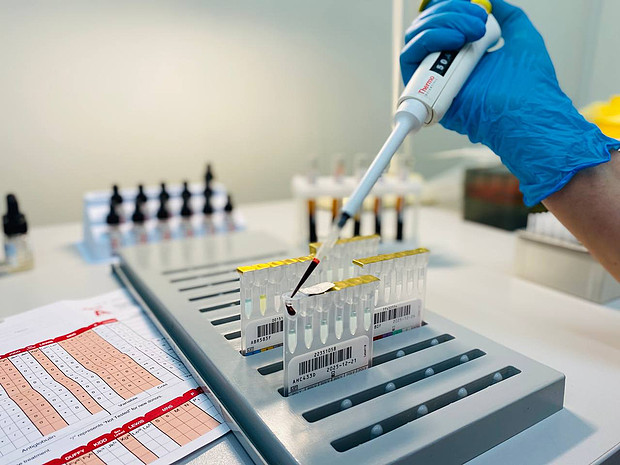 Жителю Кировской области потребовалось переливание редчайшей крови