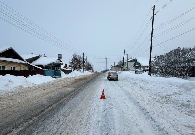 13-летняя школьница попала под колеса авто в Котельниче